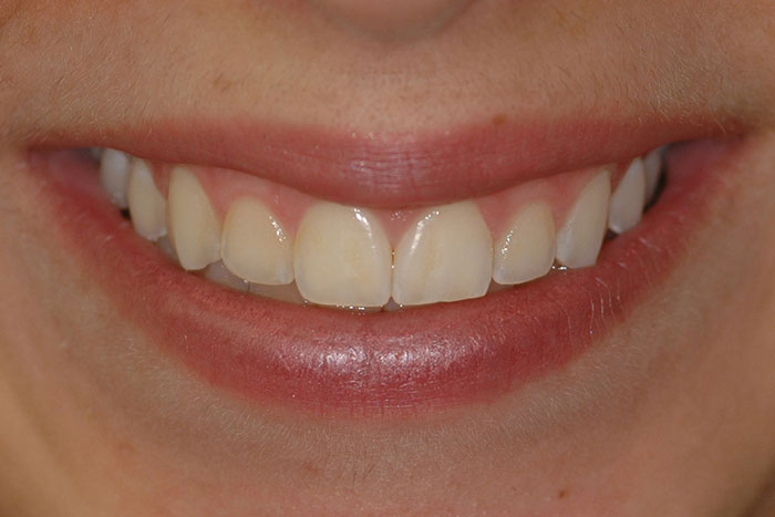 Gum & Bone Health | Aldente Dentistry